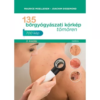   135 bőrgyógyászati kórkép tömören (Új kiadás) - Maurice Moelleken, Joachim Dissemond
