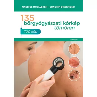   135 bőrgyógyászati kórkép tömören - Maurice Moelleken - Joachim Dissemond